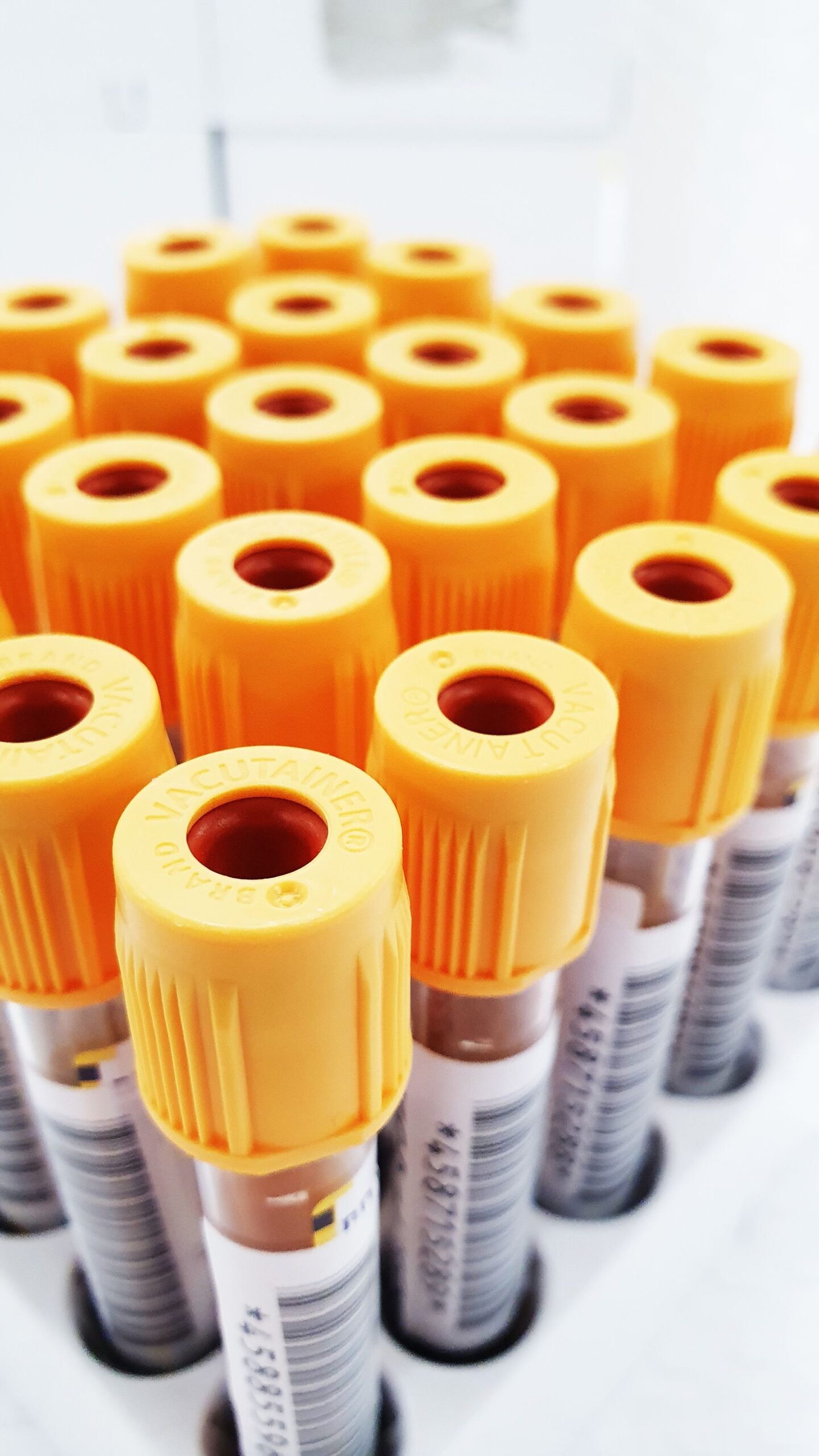 Tubos de analítica: la función tiroidea se valora con un análisis de sangre, sobre todo la TSH